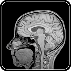 head MRI