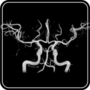 MR angiography